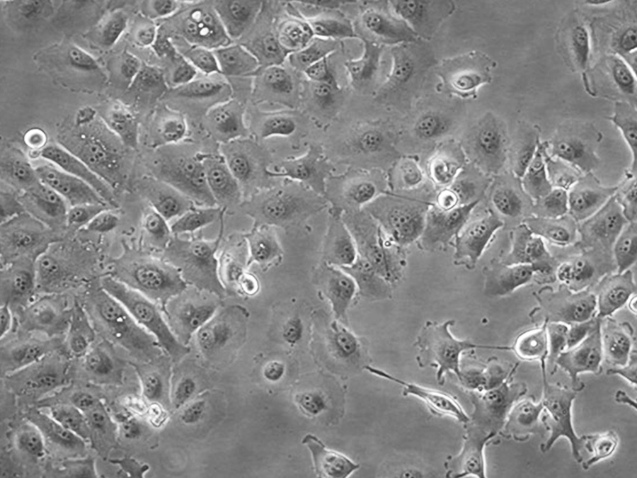caki-2细胞系（人肾透明细胞癌细胞系、乳头状肾细胞癌细胞）