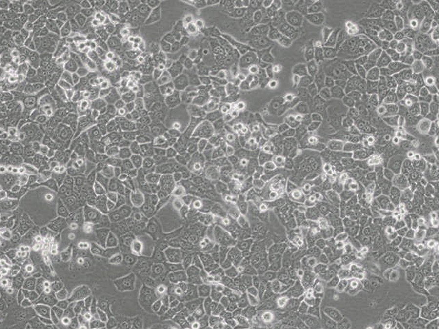 NCI-H2126细胞（人肺癌细胞）
