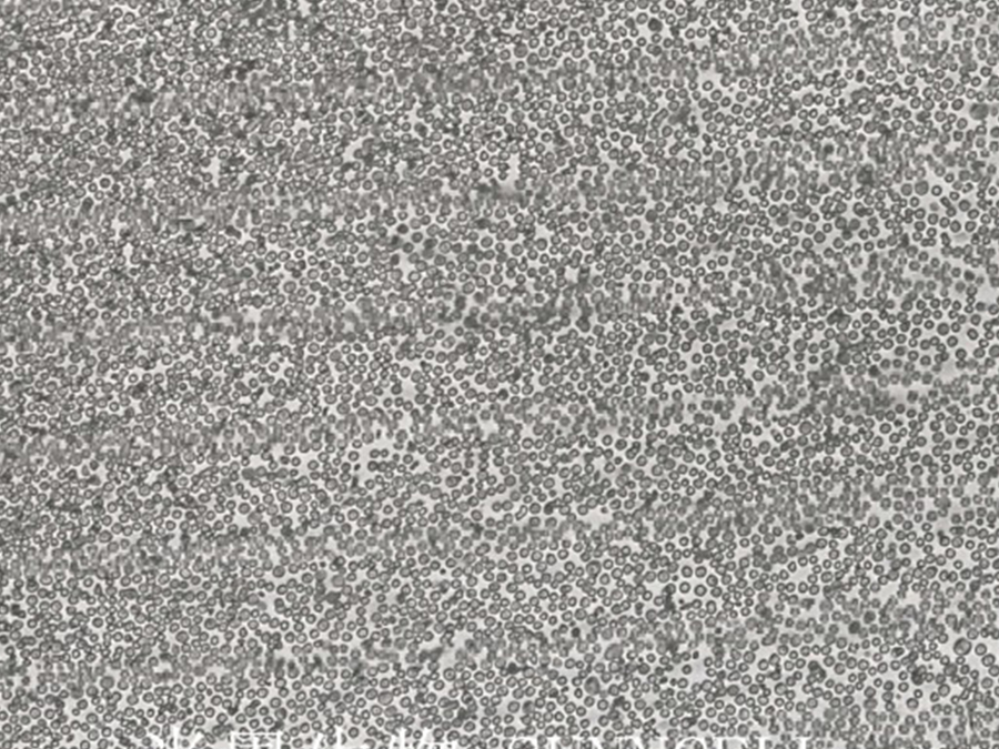 pfeiffer细胞(人弥漫大B细胞淋巴瘤细胞系) pfeiffer细胞(人弥漫大B细胞淋巴瘤细胞系)