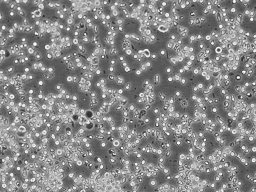 MM.1S细胞(人多发性骨髓瘤细胞系) MM.1S细胞(人多发性骨髓瘤细胞系)