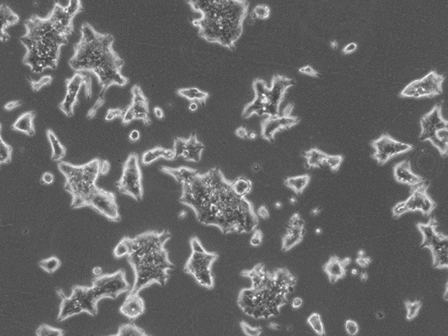 RS1细胞（大鼠皮肤成纤维细胞系）