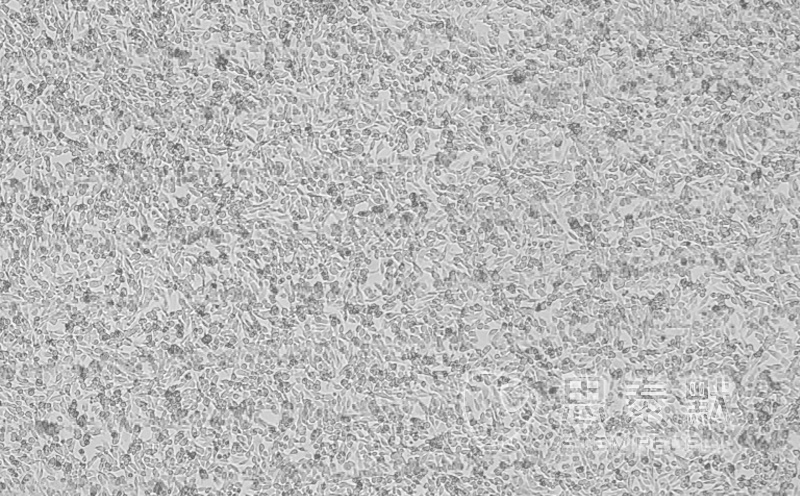 AKR细胞（小鼠食管癌细胞系）