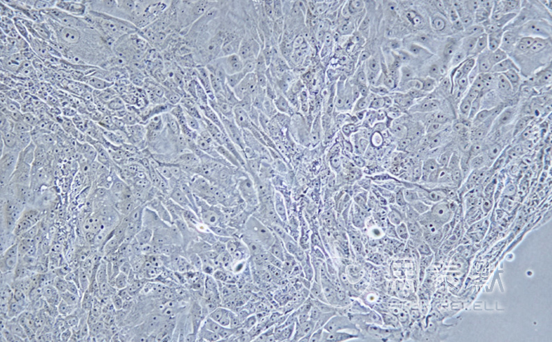 NCI-H1648细胞（人肺癌腺癌细胞系）