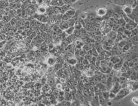 TE-12细胞（人食管癌细胞）