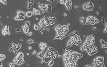 VCaP细胞（人前列腺癌细胞株）