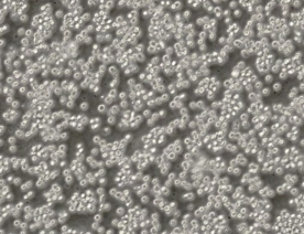 COC1细胞（人卵巢癌细胞株）