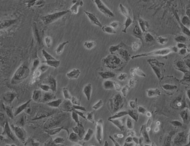 NCI-H1975人肺腺癌细胞