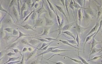 16hbe细胞和Beas2b细胞的区别