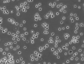 WSU-DLCL2细胞（人弥漫大B淋巴瘤细胞）