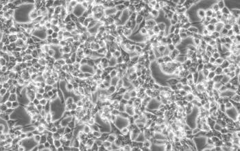 293E细胞【人胚肾细胞(EBNA1基因修饰)】