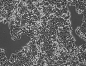 NCI-H1395细胞 (人肺腺癌细胞)
