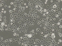 NCI-H508细胞（人结肠直肠腺癌细胞）