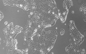 MKN-7细胞（人胃癌细胞）