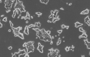 RS1细胞（大鼠皮肤成纤维细胞系）