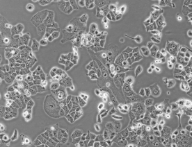 HEC-1-B细胞（人子宫内膜腺癌细胞）