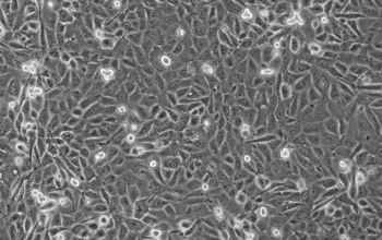 ID8细胞系（小鼠卵巢上皮癌细胞）