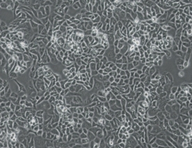 ncih522细胞（人非小细胞肺癌细胞）