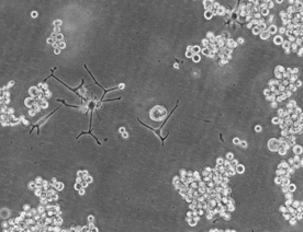 SK-MEL-1细胞（人皮肤黑色素瘤细胞）