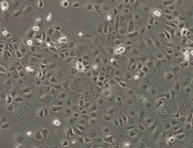 Hcc1937乳腺癌细胞（人乳腺导管癌细胞系）
