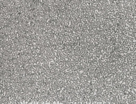 pfeiffer细胞（人弥漫大B细胞淋巴瘤细胞系）