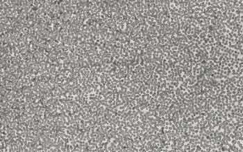 pfeiffer细胞（人弥漫大B细胞淋巴瘤细胞系）