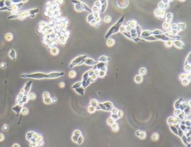 B95-8细胞（绒猴EB病毒转化的白细胞）