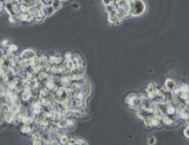 NCI-H82细胞（人小细胞肺癌细胞）
