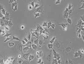 HCC1588细胞（人肺鳞癌细胞）