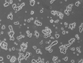 NCI-H209人小细胞肺癌细胞系