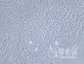NCI-H1648细胞（人肺癌腺癌细胞系）