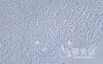 NCI-H1648细胞（人肺癌腺癌细胞系）
