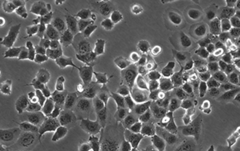 NCI - H1299人非小细胞肺癌细胞