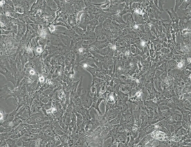 HCC38细胞（人乳腺导管癌细胞系）