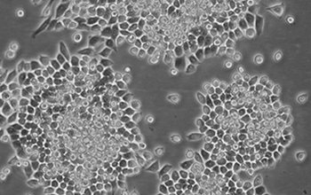 HeLa-S3细胞系（人宫颈癌细胞系）