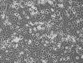 UM-UC-3细胞（人膀胱移行细胞癌细胞）