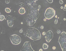 SW1116人结肠腺癌细胞