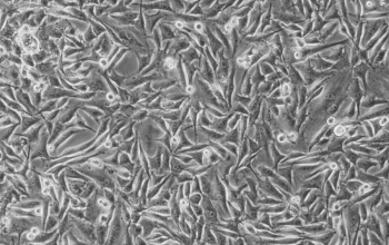 WM115细胞（人恶性黑色素瘤细胞）