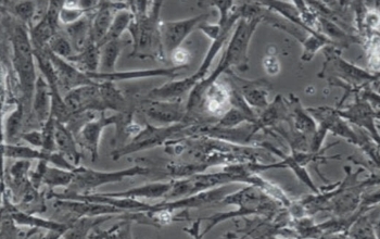 小鼠原代肺成纤维细胞