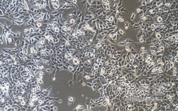 GL261-luc细胞（小鼠胶质瘤细胞系）