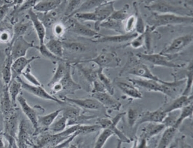 OCUT-2C细胞（人未分化甲状腺癌细胞）
