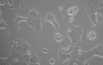 RT4细胞（人膀胱移行细胞乳头瘤细胞）