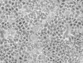 NIH:OVCAR-3人卵巢癌细胞