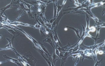 人视网膜微血管内皮细胞（HRCEC细胞、原代细胞）