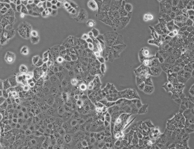 HEC-1-A细胞（人子宫内膜腺癌细胞）