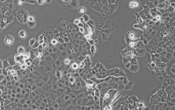 HEC-1-A细胞（人子宫内膜腺癌细胞）
