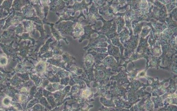 HuH-7细胞系（人肝癌细胞）