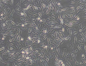 MDA-MB-231(DMEM)人乳腺癌细胞