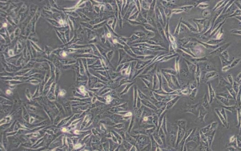 MDA-MB-231(DMEM)人乳腺癌细胞
