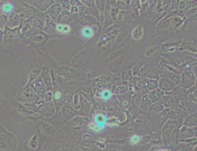 SCC-9人鳞状上皮舌癌细胞（人舌鳞癌细胞）