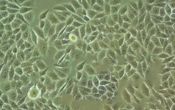 HEK-293细胞的推荐培养条件和细胞密度是什么？